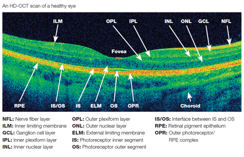 HD OCT Scan