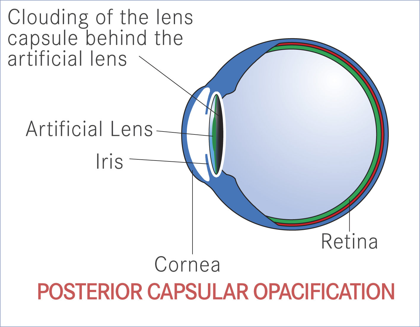 Gartry Eye Diagrams 20251