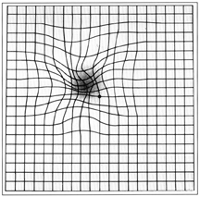 Amslergrid Patient