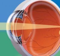 Eye Anatomy - understanding your eye