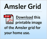 Promo Amsler Grid